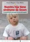 NUESTRA HIJA TIENE SINDROME DE DOWN